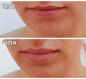 עיצוב שפתיים מושלמות